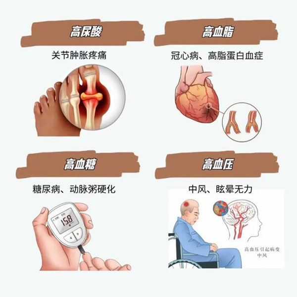 慢性病趋势预警